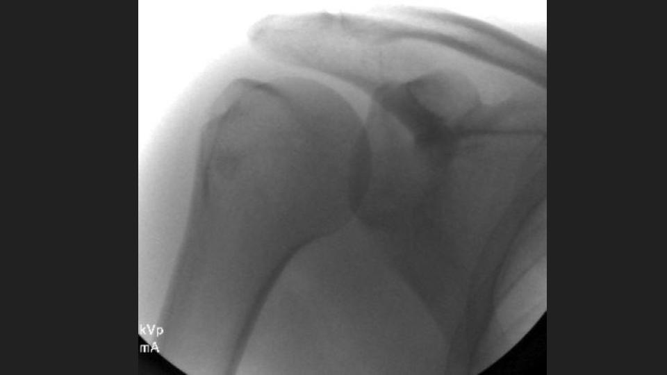 Figure 1 for case dislocation ( RID4770 )